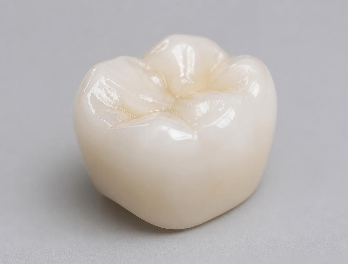 Close macro view of a finished ceramic dental restoration on a working model